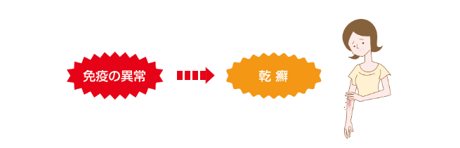 乾癬発症の原因として、免疫の異常が関連していると考えられています