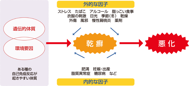 乾癬は、免疫に異常をきたしやすい体質の人に、外的な因子(ケガや感染症、ストレスや乾燥などの刺激、食生活)や内的な因子(糖尿病、高脂血症、肥満など)が加わることで発症するのではないかと考えられています。