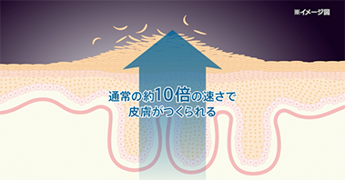 通常の約10倍の速さで皮膚がつくられる