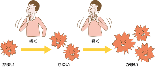 掻くことは逆効果。肌には刺激を与えないことが大事